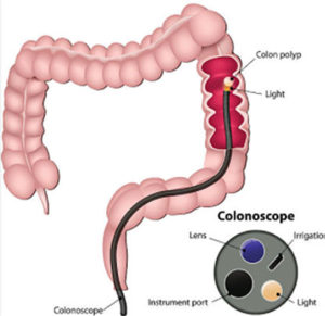 colon image